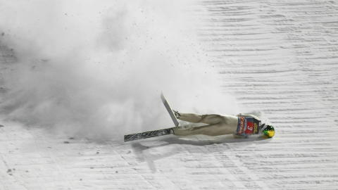 FORSL�TT: Tom Hilde var blodig og forsl�tt i ansiktet etter fallet. 
Foto: Terje Bendiksby / Scanpix