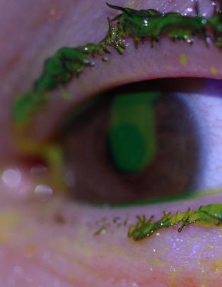 16 personer fikk  �yeskader etter fyrverkeri