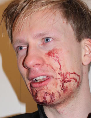 - De spurte om vi var �p� vei hjem for � pule�