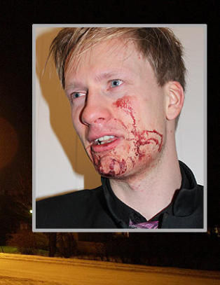 - Vi har mottatt 20 hat- meldinger p� �n m�ned