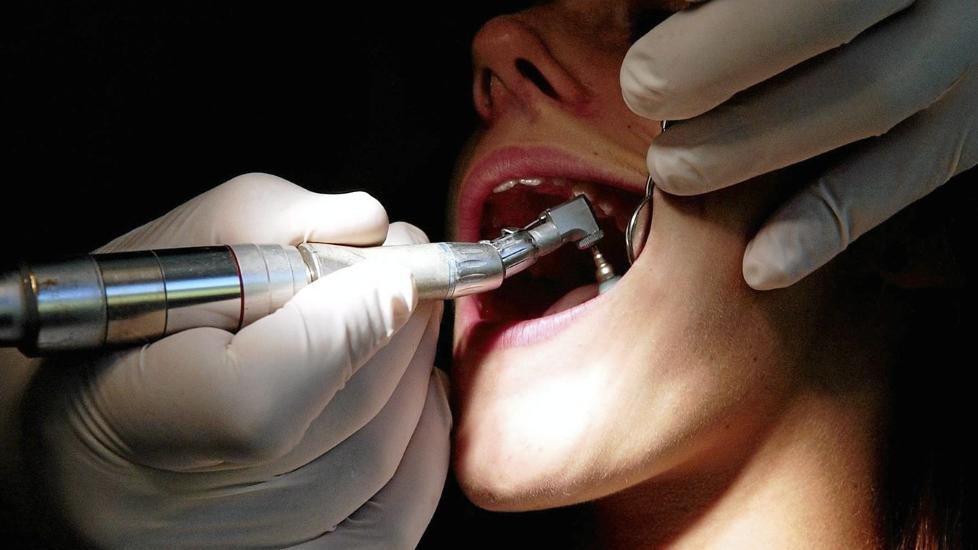 UNDERS�KELSE: Det har vist seg at de som fikk profesjonell tannrens minst to ganger i �ret i l�pet av to �r, reduserte risikoen for hjerteinfarkt med 24 prosent.  ILLUSTRASJONSFOTO: Colourbox