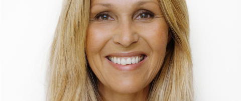 - Jeg har tatt Botox
