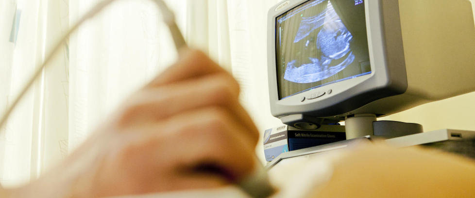 �Klokka ti p� fire en sein vinterdag fikk vi telefonen vi fryktet - v�rt foster hadde et alvorlig syndrom�
