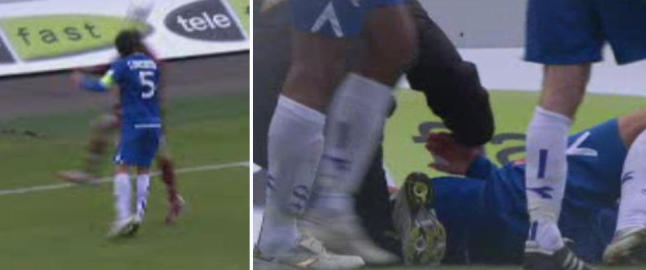 - Sjelden jeg har sett så kraftige ansiktsskader hos en fotballspiller