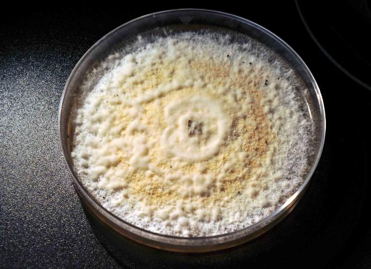 SPISER PLAST: Soppen Pestalotiopsis microspora spiser visse typer plast. Slik ser soppen ut når den er midt i måltidet. Foto: New Haven Register SPISER PLAST: Soppen Pestalotiopsis microspora spiser visse typer plast. Slik ser soppen ut når den er midt i måltidet. Foto: New Haven Register