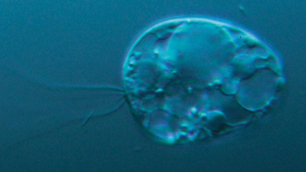  HUNDRE MILLIONER �R:  -Collodictyon er blant de eldste eukaryote organismene vi kjenner, og ble skapt for flere hundre millioner �r siden. Med denne organismen kan vi bedre forst� hvordan det tidlige livet p� Jorda s� ut, sier leder for MERG, Shalchian-Tabrizi til Dagbladet. Foto: MERG/UiO