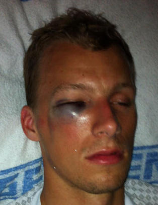Slik s� Andr� (22) ut etter kollisjonen med Kovacs