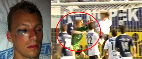 Slik s� Andr� (22) ut etter kollisjonen med Kovacs