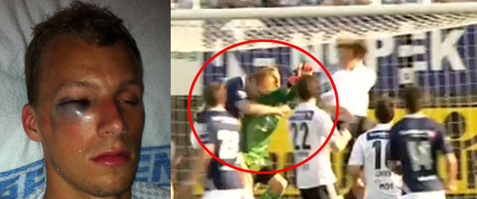 Slik s� Andr� (22) ut etter kollisjonen med Kovacs