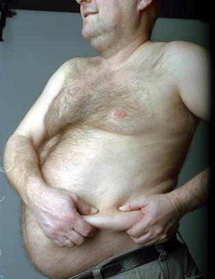 Pappafedme kan doble risiko for barneautisme
