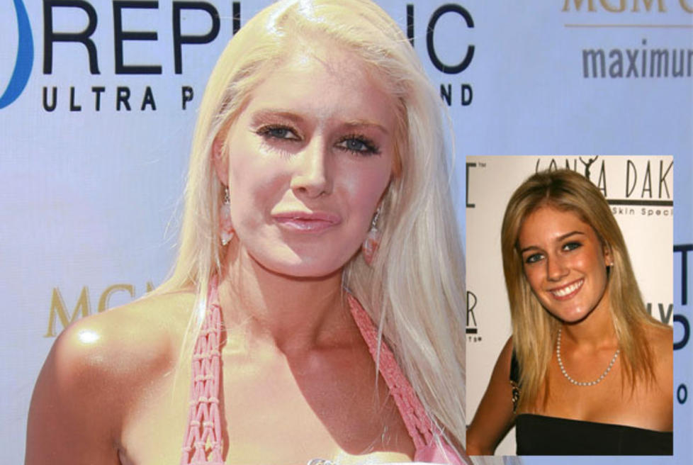  F�R OG N�:  Heidi Montage hadde utseendet til en �american sweetheart� da hun slo igjennom med reality-serien �The Hills� p� midten av 2000-tallet. N� er utseende hennes preget av � ha gjennomf�rt plastiske inngrep. Foto: Stella Pictures