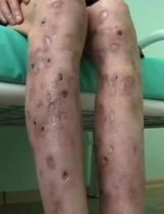 13-�ring vitne til at moren r�tnet bort