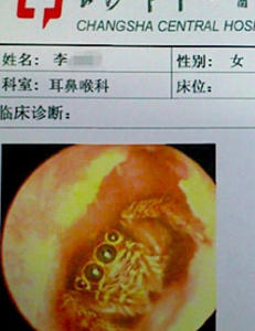 Dette bildet er tatt inne i �ret p� en kvinne