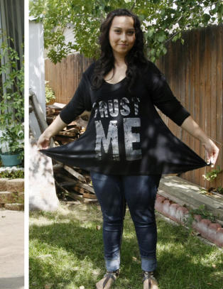 Jazmine m�tte ta slanke- operasjon da hun var 17