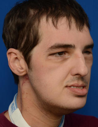 Skuddoffer t�r endelig vise seg p� gata igjen