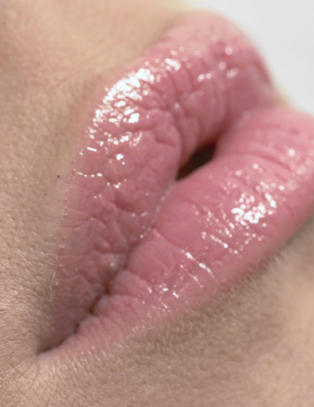 Dette gj�r du med store porer