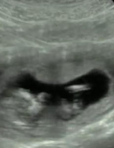 - Jeg bare visste det var noe p� gang