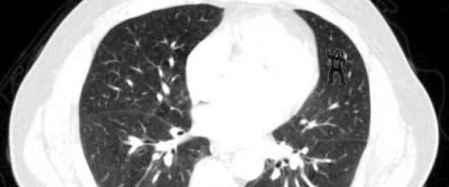 Kan du finne gorillaen som danser i disse lungene?