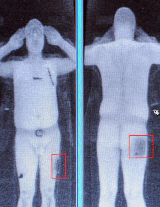 N� kommer �nakenskanneren� p� norske flyplasser