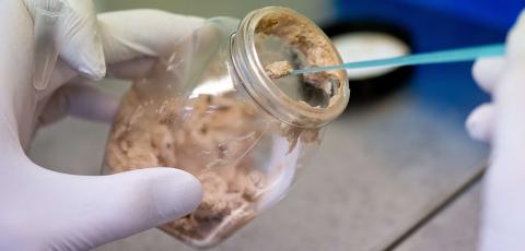 FRYKTER MEDISINER: Samtidig som Tysklands utviklingsminister g�r ut og sier at hestekj�ttet b�r gis til verdens fattige, frykter forskerne at kj�ttet inneholder farlige medisiner. Her fra et laboratorium i Berlin. Foto: Scanpix