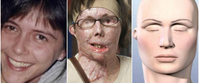 I 2007 dynket eks-mannen Carmen (44) i lut, nå har hun endelig fått sitt nye ansikt