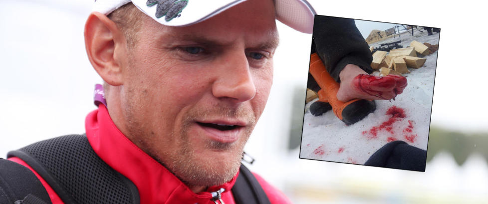Olaf Tufte kappet seg i foten med �ks