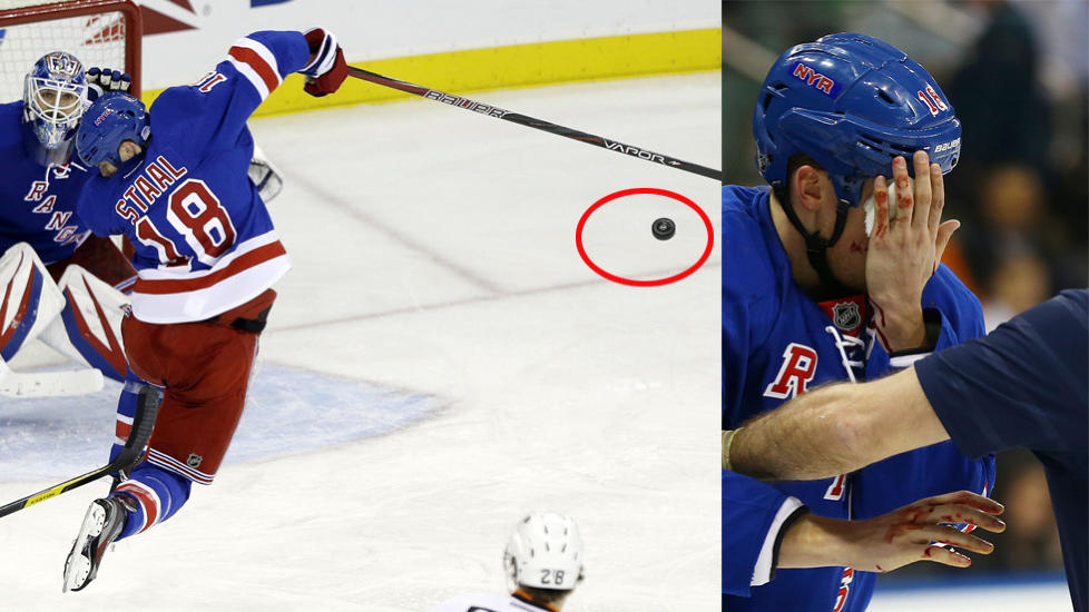 TRUFFET I ANSIKTET: NHL-spilleren Marc Staal fra NY Rangers ble truffet av et skudd i kampen mot Philadelphia Flyers i natt. Foto: AP Photo/Getty images/AFP