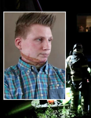 Axel (20) klatret opp p� et tog - fikk 16 000 volt gjennom kroppen