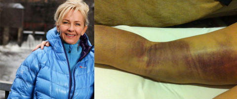 Rev l�rmuskelen rett av i �Amazing Race�