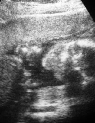 Gynekologer gir opp abortkamp