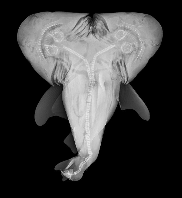 INNSYN: Et MR-bilde av haifosteret viser at det har adskilte hoder, hjerter og mager. Foto: Patrick Rice / Shark Defense / Florida Keys Community College