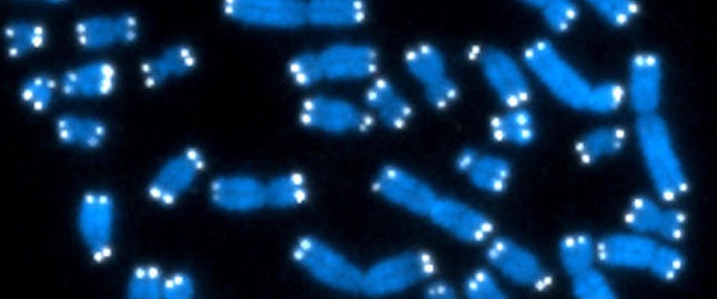 Lengden p� de lysende prikkene er med p� � bestemme hvor lenge du lever