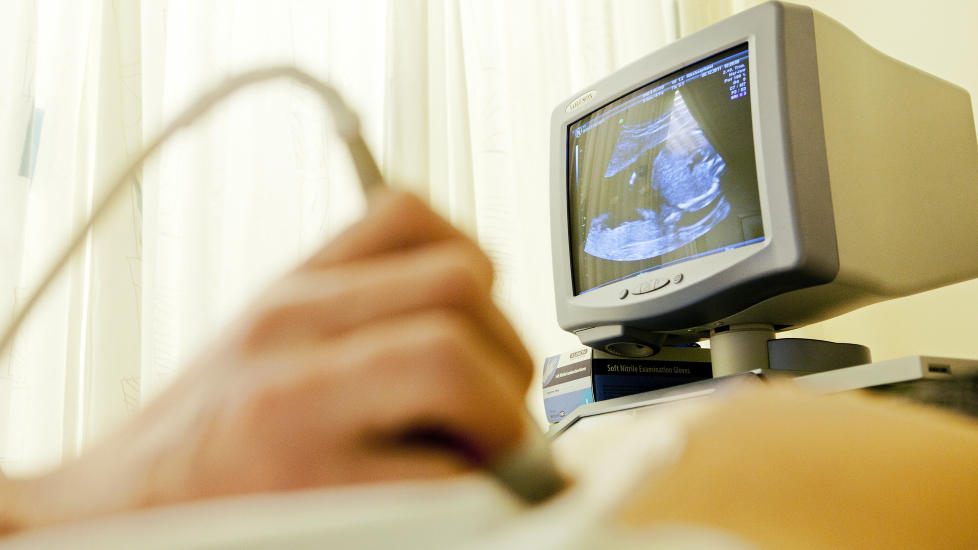 EKSKLUDERENDE: Et samfunn som fjerner enkelte utgrupper etter hvert ikke finner plass til noen som er annerledes, frykter Jahn Otto Johansen. Foto: Tore Meek / NTB Scanpix