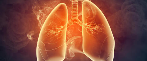 Slik lever du bedre med kols