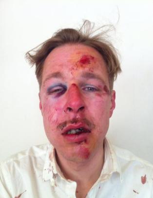 - Dette er homofobiens ansikt