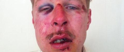 - Dette er homofobiens ansikt