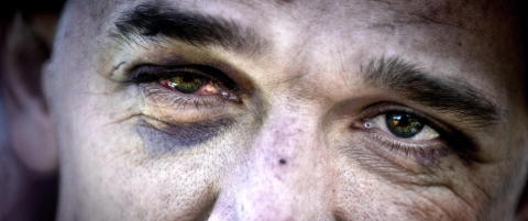 �Erik� er langt fra den eneste som har klaget p� beltesenga