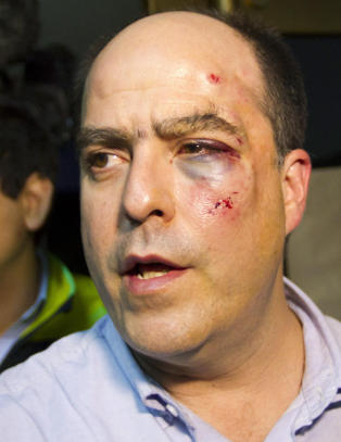 Slik s� politikeren ut etter � ha tapt �valgkampen�