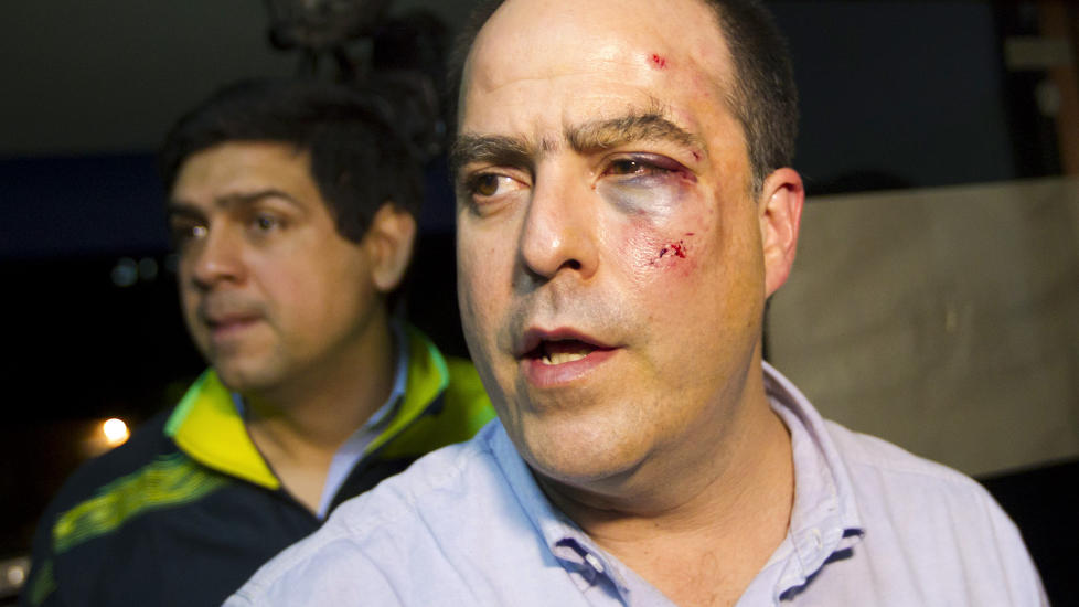 FIKK EN RETT H�YRE P� VENSTRESIDA: Opposisjonspolitiker Julio Borges i Venezuela viser sine s�r etter at det utbr�t slosskamp i nasjonalforsamlinga i landet i g�r. Det er stor uenighet etter valgresultatet om ny president i landet. Foto: REUTERS / Carlos Garcia Rawlins / NTB scanpix