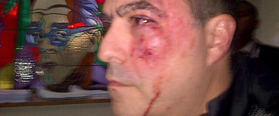 Knyttnever, bl�veis og
skjellsord i Venezuela