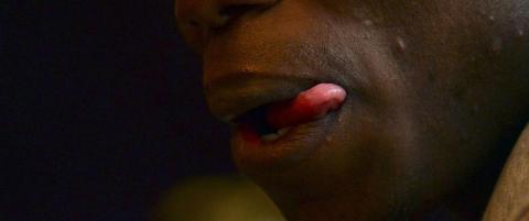 Pogba straffet etter spyttklyse