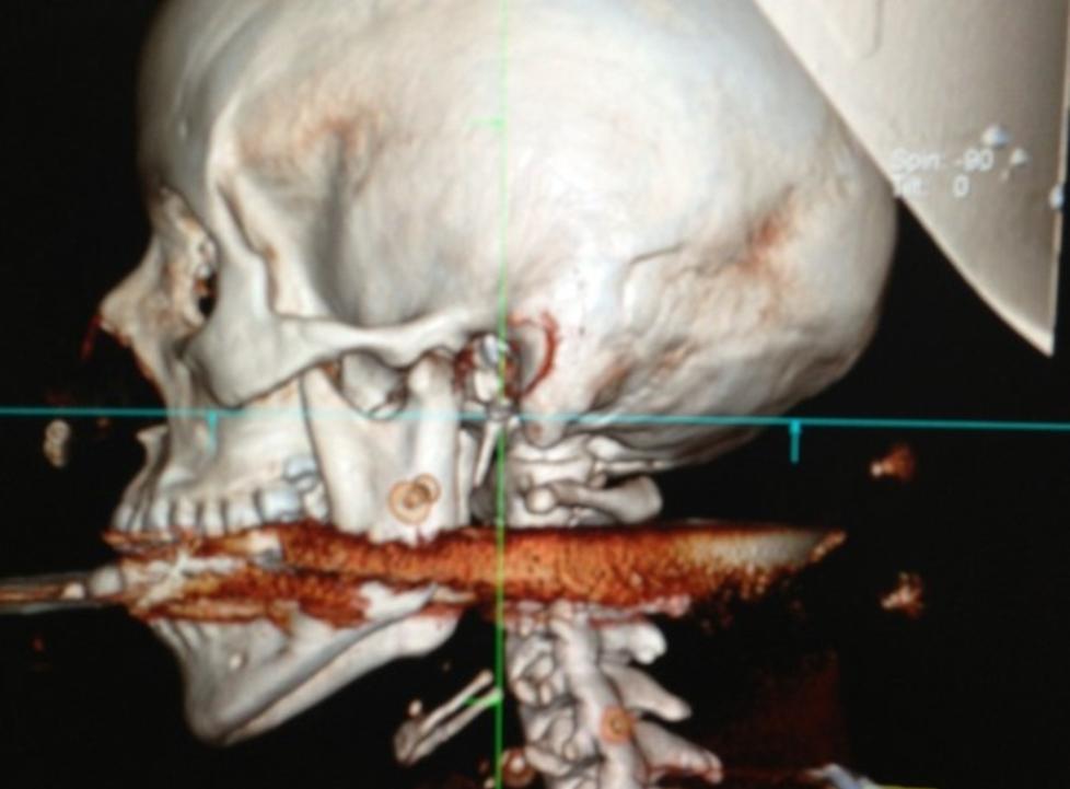 N�R D�DEN: Arraial do Cabo har offentliggjort dette bildet fra operasjonen. Foto: Handout