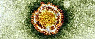 Finner d�dsviruset p� noen timer