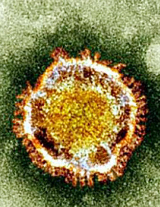 Finner d�dsviruset p� noen timer