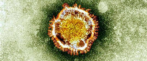 Finner d�dsviruset p� noen timer