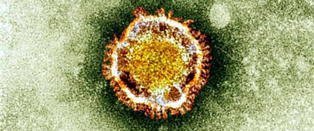 Finner d�dsviruset p� noen timer