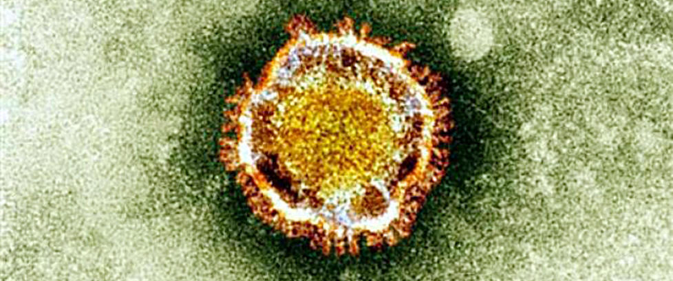 Finner d�dsviruset p� noen timer