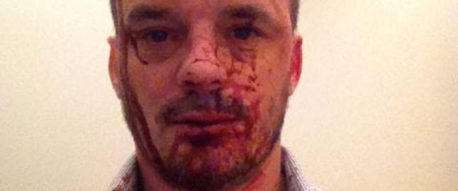 Cristopher ble overfalt etter egen bursdagsfest