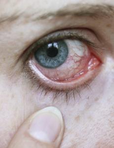 Enkle tips mot pollenplagene