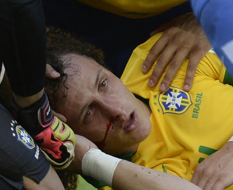 David Luiz fullf�rte cupkamp etter stygg hodesmell